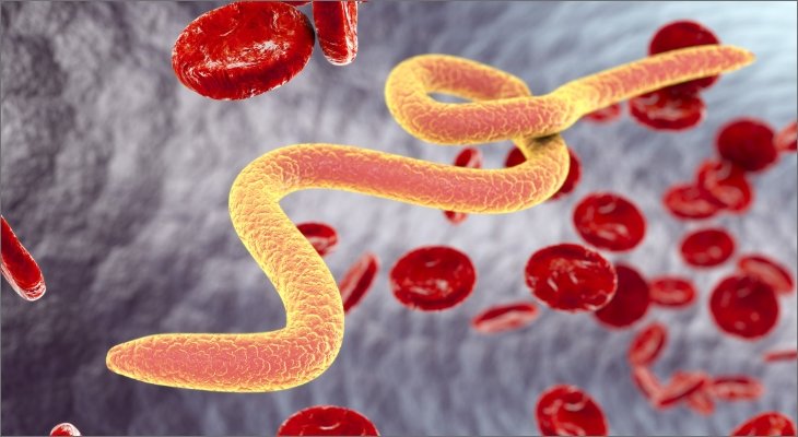 30-Day Deep Parasite Protocol: A Natural Herbal Cleanse for Gut Health and Detox